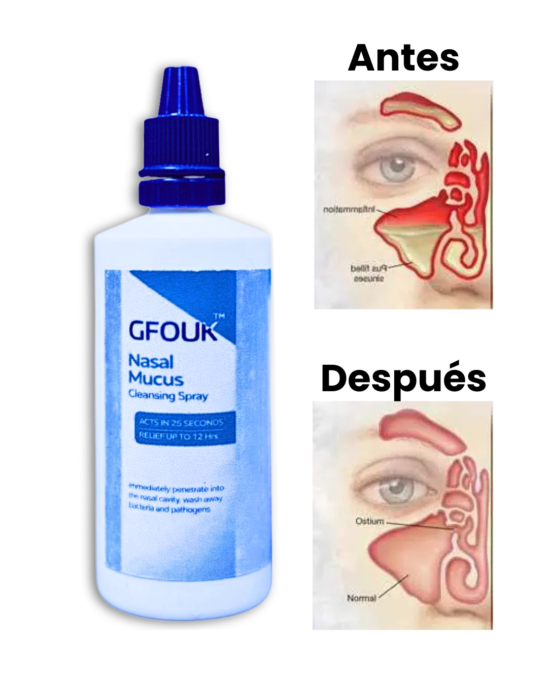Gfouk Limpiador Nasal profesional